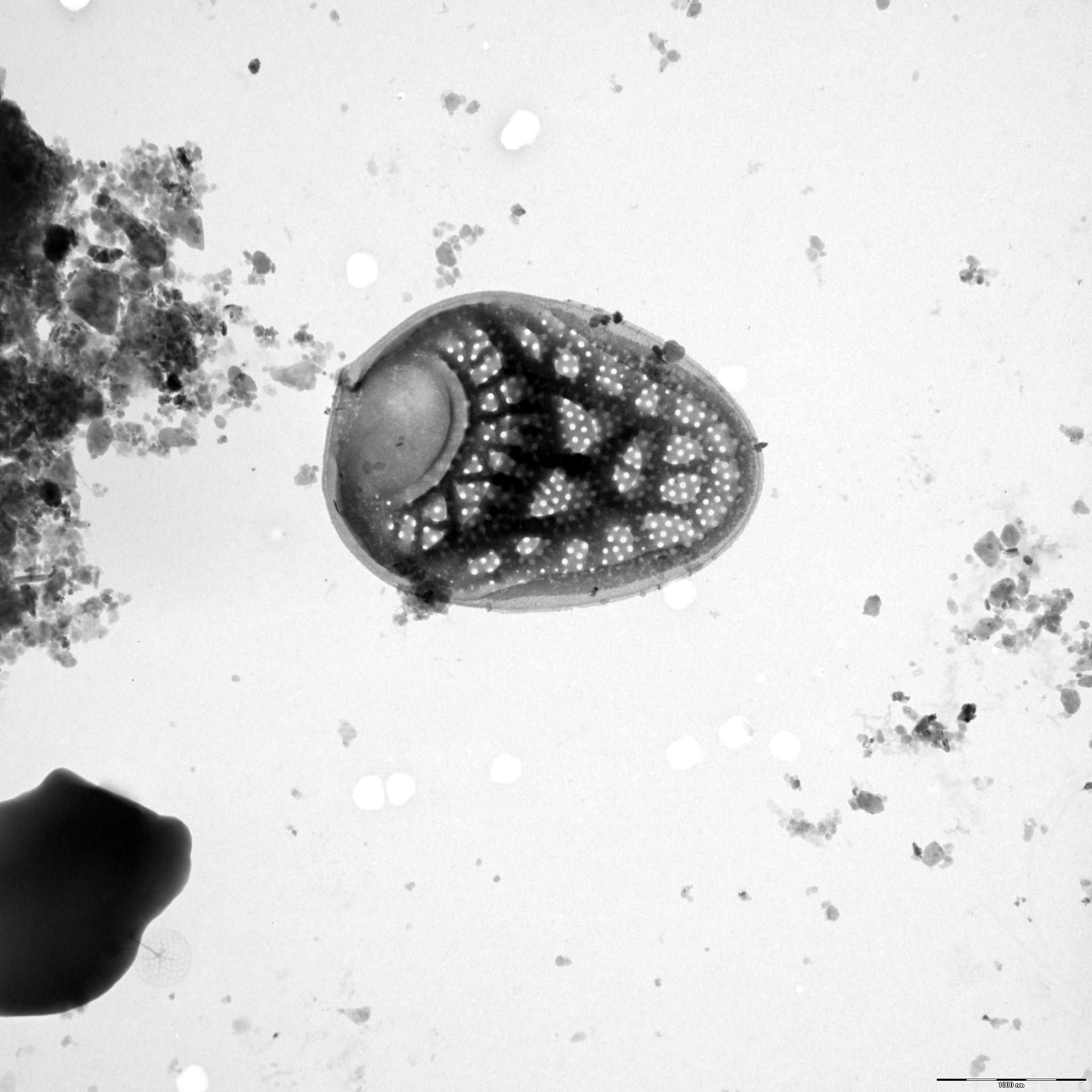 Mallomonas heterospina | Silica-scaled chrysophytes of Europe